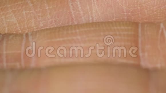 白细白种人的皮肤在手中手指在宏观上特写视频的预览图