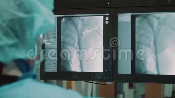 手术室医生在手术室里做手术看监视器视频的预览图
