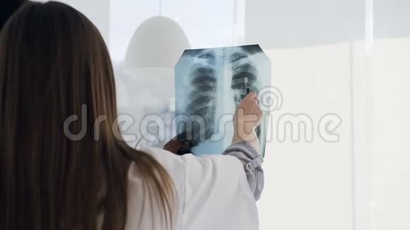 年轻的男女医生在医院讨论病人的x射线指纹视频的预览图