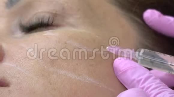 美容师在女孩的脸颊上给病人打针视频的预览图