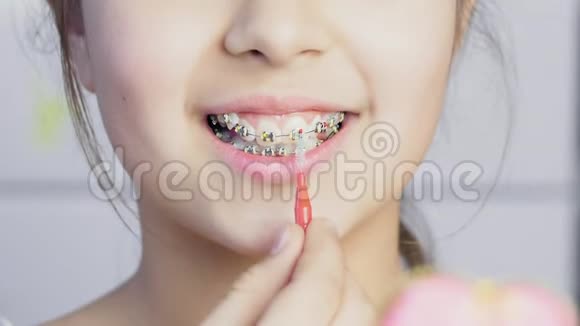少女用透明金属牙套清洁牙齿视频的预览图
