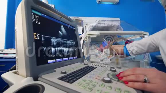 婴儿超声过程中的计算机显示视频的预览图