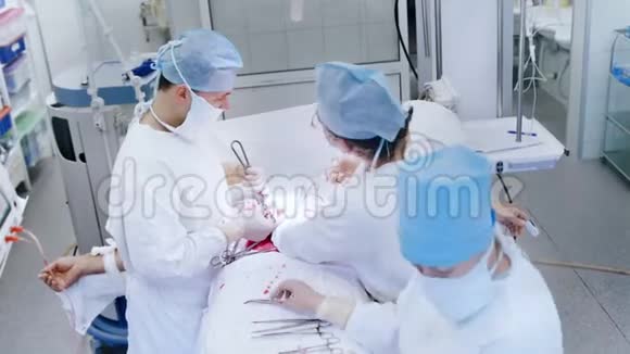 手术室进行腹腔手术的专业外科医生俯视图组视频的预览图