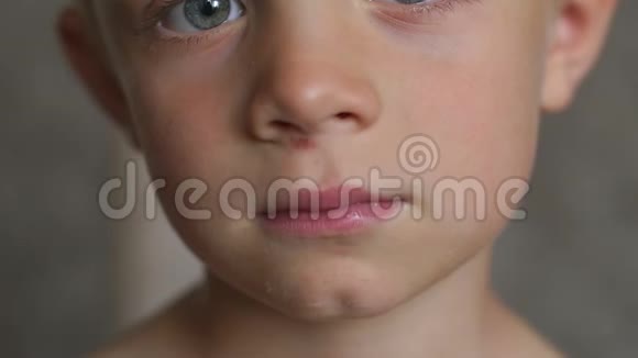 孩子掉下来挠了挠鼻子下面的皮肤男孩脸上的伤口视频的预览图