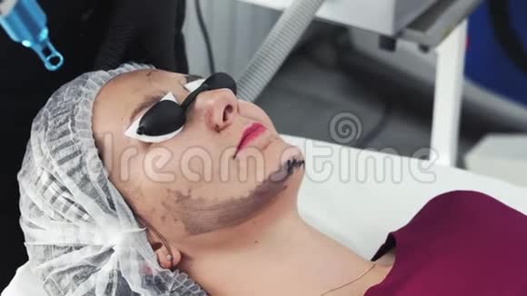特写美容师做碳剥离手术激光闪光清洁病人面部皮肤视频的预览图