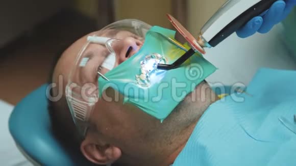 牙科治疗光用于牙齿治疗的观点4K视频的预览图