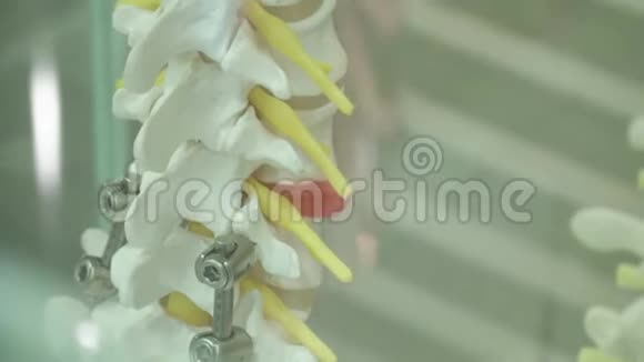 金属假肢人体脊柱修复实例视频的预览图
