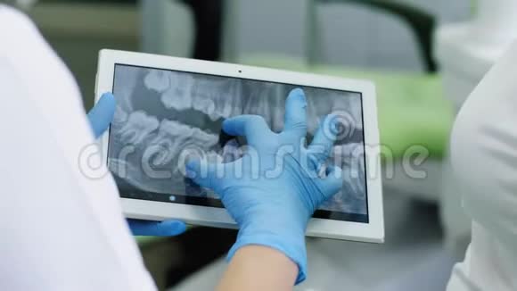 牙医在数字平板上看人牙X光视频的预览图