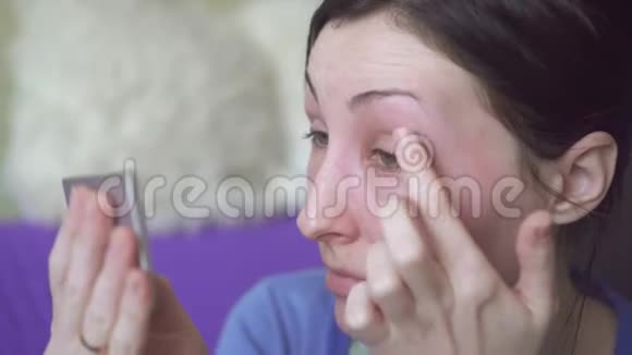 女孩的脸肿了过敏反应视频的预览图