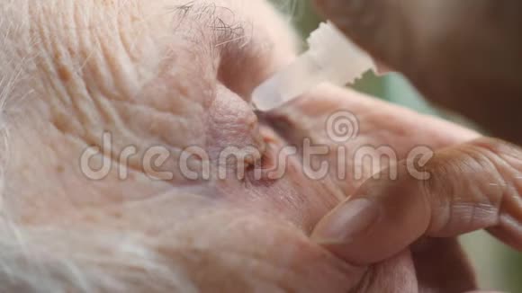 一个老女人滴在眼里的医疗滴祖母感染和眼睛发炎的肖像视频的预览图