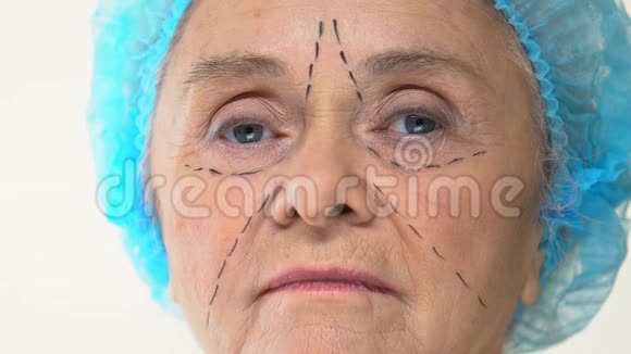 老年女性面部有手术痕迹整形外科医生拿着手术刀视频的预览图