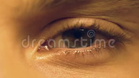 患有干眼症和眨眼的人眼科的人视频的预览图