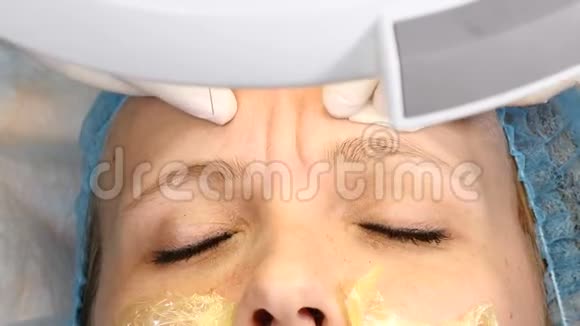 在现代美容诊所接受面部注射的年轻女性保持美的观念4k注射肉毒杆菌视频的预览图