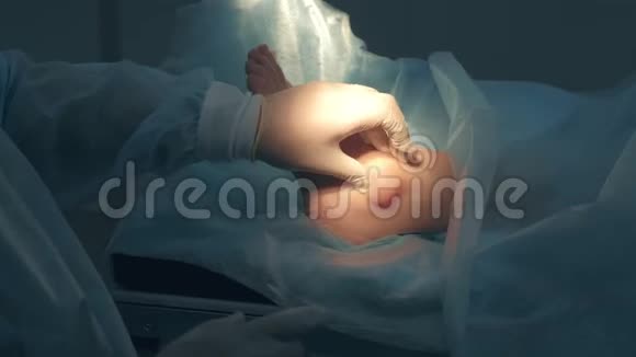外科医生在手术前触诊腿部以去除关节中的脚踝湿瘤视频的预览图