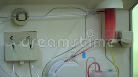 质粒分离通过设备清洗病人的血液血浆的排泄过程视频的预览图