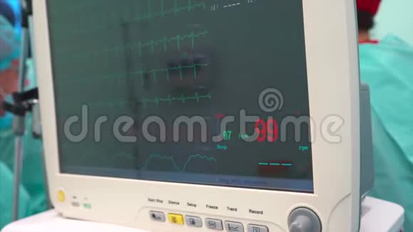 心脏导管有一个明亮的波片段视频的预览图
