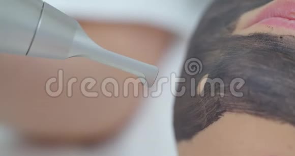 碳面剥离工序激光脉冲清洁面部皮肤硬件美容治疗程序视频的预览图