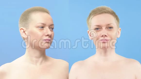 女人的肖像鼻成形术前后的比较视频的预览图