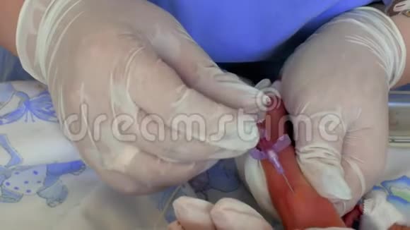 一位医生在重症监护病房里用一根针扎住一个早产儿的腿上医生视频的预览图
