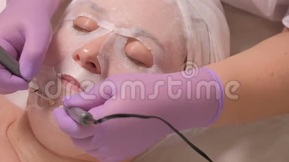 关闭微电流治疗一位戴着紫丁香手套的专业美容师使用一个带有两个电极的装置一张脸视频的预览图
