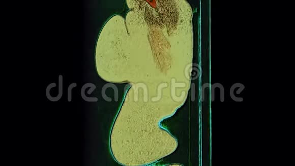 肺部和支气管彩色MRI扫描呼吸道疾病诊断视频的预览图