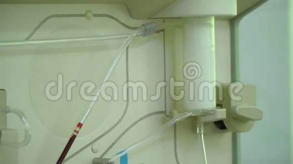 质粒分离通过这个装置清洗病人血液血浆的排泄过程视频的预览图