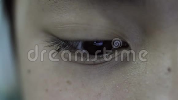 亚洲男孩脸特写黑眼圈眨着眼睛看着屏幕视频的预览图