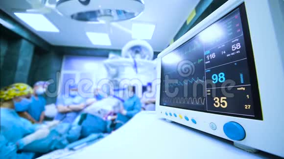 一群外科医生在病人的生命功能监视器上做手术视频的预览图