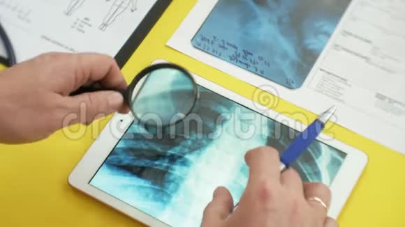 保健和医疗理念数字平板电脑屏幕上的X射线图像医疗桌侧视图视频的预览图