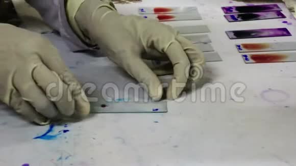一位病理学家戴着手套在玻璃玻片上画了一张血迹视频的预览图