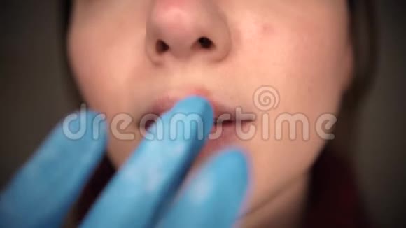 唇上有疱疹女人的一部分嘴唇上有手指的脸上有疱疹美容的概念视频的预览图