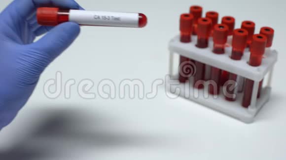 CA153医生在试管中显示血样实验室研究健康检查视频的预览图