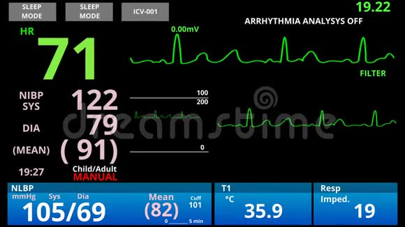 医学生命体征监测仪心脏传感器病人健康状况诊断视频的预览图