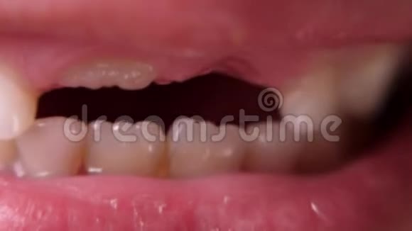 宝宝牙齿宏拍无牙的微笑一颗摇摇晃晃的牙齿切根牙舌头在牙齿之间的洞里视频的预览图