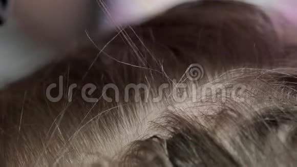 儿童头蒂下垂的治疗去除女孩头发中nits和虱子视频的预览图