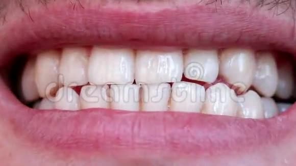 洁白的牙齿视频的预览图