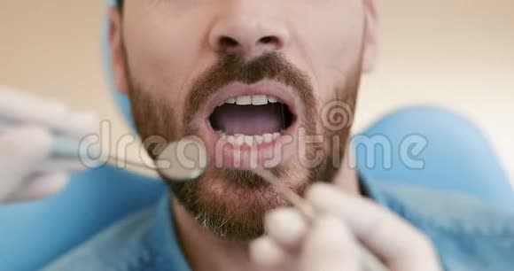 口腔检查时患者张口的特写及近旁镜子视频的预览图