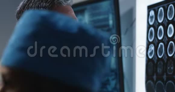 医生在看脑扫描图像视频的预览图