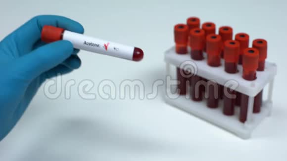 丙酮检测阴性医生抽血实验室研究健康检查视频的预览图