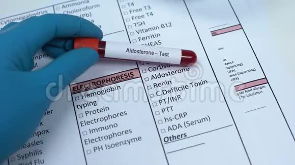 醛固酮医生在实验室空白检查激素在试管中显示血样视频的预览图