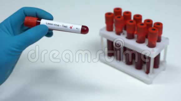 Lassa病毒检测阴性医生提供血样实验室研究医疗保健视频的预览图