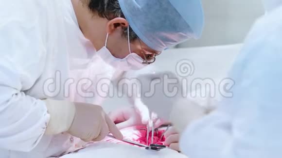繁忙的专业外科医生做腹腔手术视频的预览图