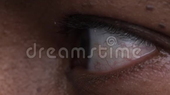 非洲裔美国人的眼睛静脉关闭视频的预览图