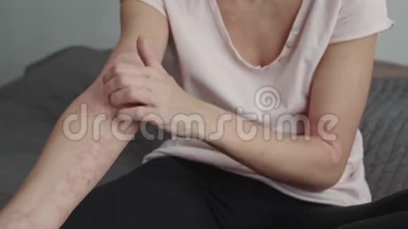 擦伤手臂有皮疹或皮炎视频的预览图