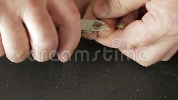 男人的手用这个工具灵活地去除脚趾上的酸痛指甲视频的预览图