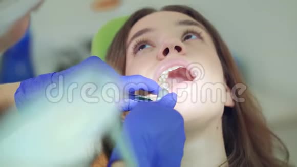 在家庭牙医治疗牙齿的女人牙医的双手在女人的嘴里工作视频的预览图