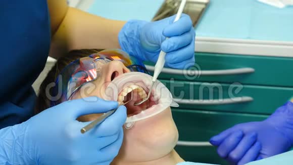 女医生在她的柜子里治疗女病人在牙科用扩张器的年轻女子近距离拍摄视频的预览图
