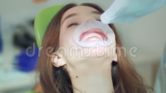 牙科诊所牙齿美白手术病人医生打开灯视频的预览图