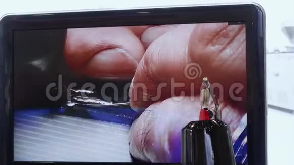 男人屏幕上的手人修理金属零件视频的预览图