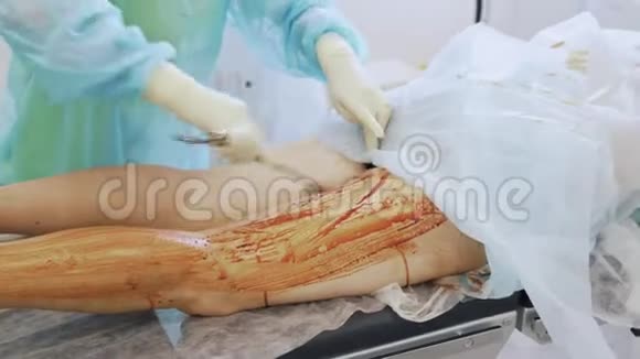 手术室手术前关闭护士手消毒病人腿部视频的预览图